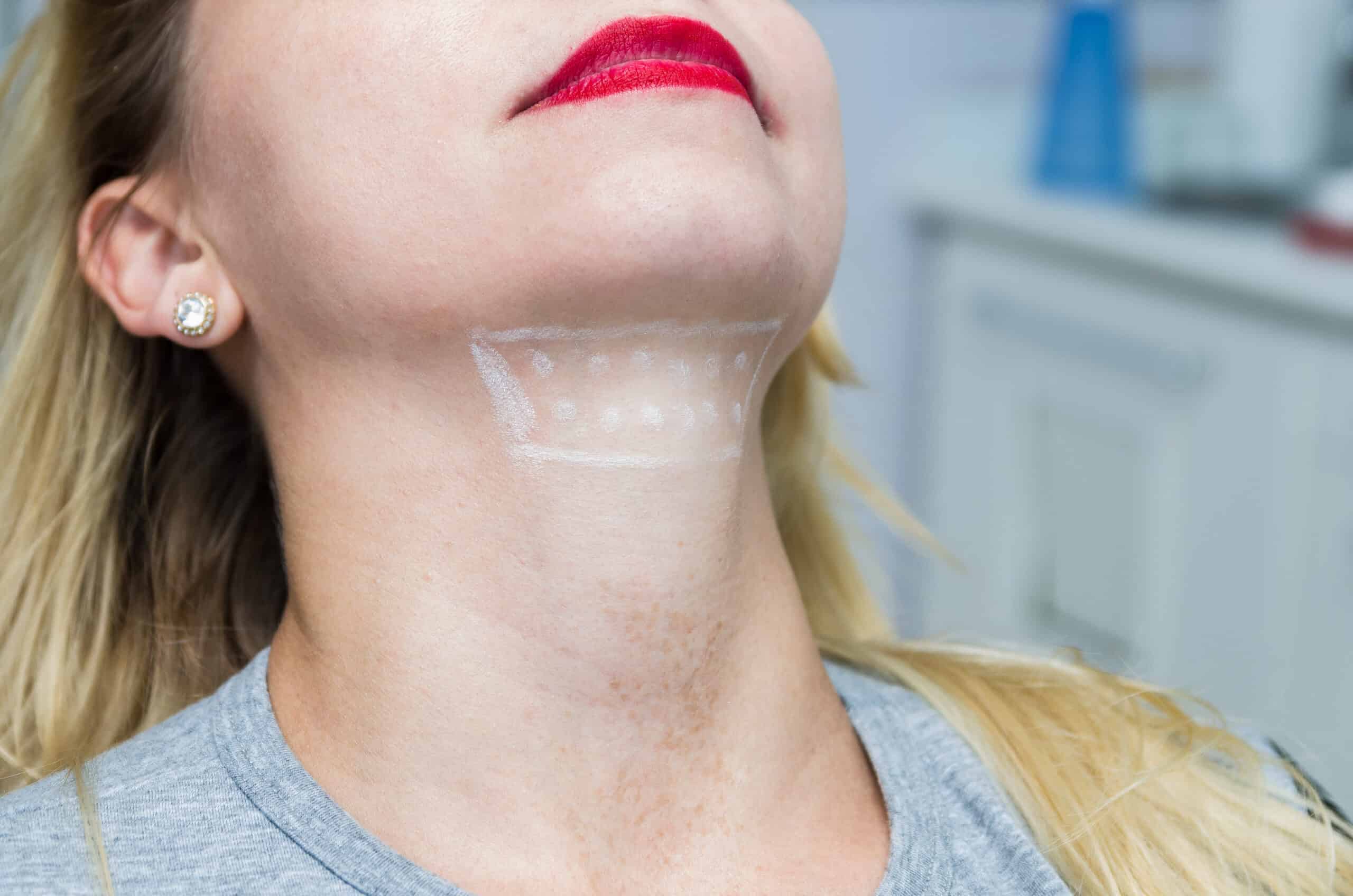 Kybella: A Revolutionary Solution for Double Chin Removal