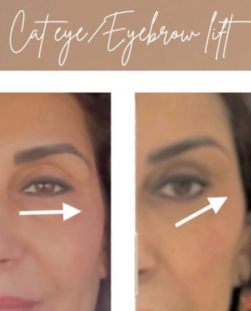 Before and after comparison of cat eye and eyebrow lift at Homa Rejuvenation showing a more lifted and defined eye area.