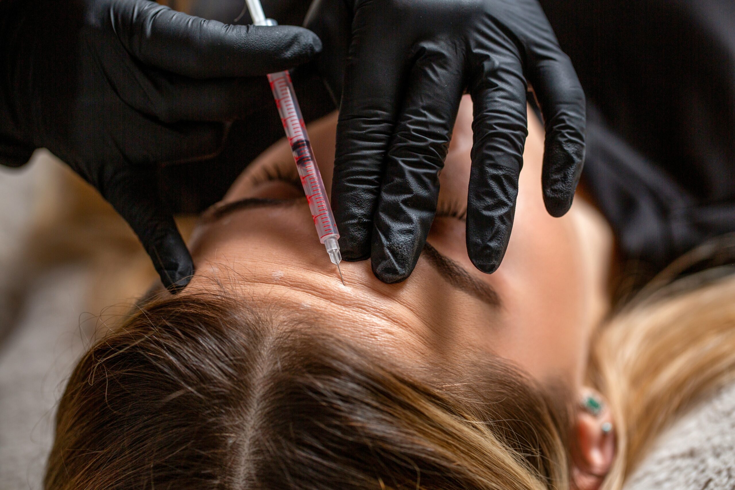 Dysport for first-time patients in Altamonte Springs FL at Homa Rejuvenation Center for natural wrinkle reduction and beginner-friendly treatment